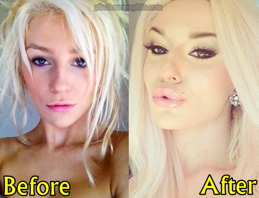 Courtney Stodden Plastic Surgery Before and After