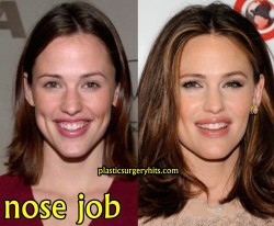 Jennifer Garner Nose Job