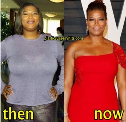 Queen Latifah Plastic Surgery Before and After