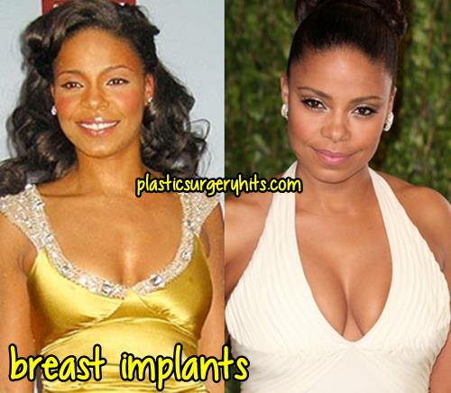 Sanaa Lathan Breast Implants