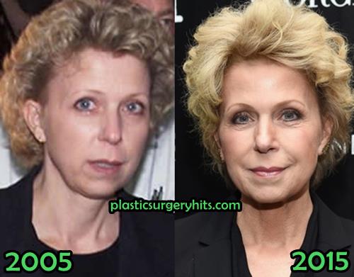 Mary Mapes Plastic Surgery Fact or Rumor