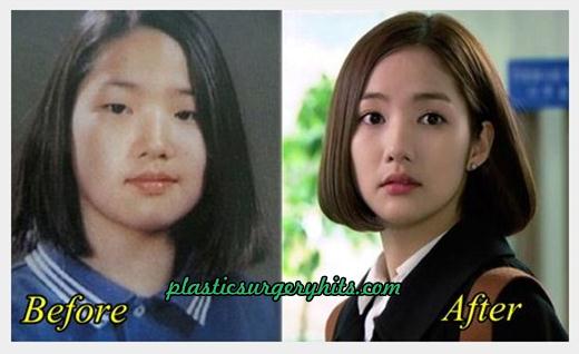 Park min Young Plastic Surgery